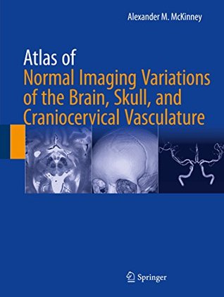 Full Download Atlas of Normal Imaging Variations of the Brain, Skull, and Craniocervical Vasculature - Alexander M McKinney | ePub