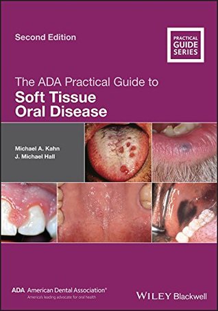 Full Download The ADA Practical Guide to Soft Tissue Oral Disease - Michael A. Kahn | ePub